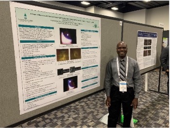 A Case of Blunt Ocular Trauma Complicated by Hyphema, Intraocular Pressure Elevation and Traumatic Uveitis, by Sylvester Cobbina, O.D.
