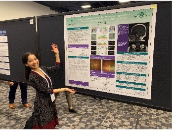 Differentiating Early Idiopathic Intracranial Hypertension from Pseudopapilledema: A Diagnostic Challenge by Sweta Das, O.D. 