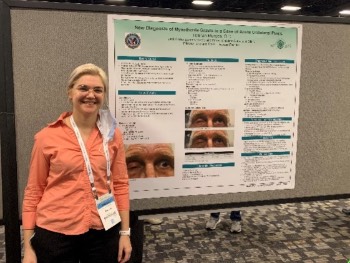 New Diagnosis of Myasthenia Gravis in a Case of Acute Unilateral Ptosis by Hannah Munyan, O.D.
